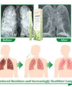 𝐌𝐮𝐥𝐥𝐞𝐢𝐧 𝐇𝐞𝐫𝐛𝐚𝐥 𝐋𝐮𝐧𝐠 𝐏𝐮𝐫𝐢𝐟𝐢𝐞𝐫