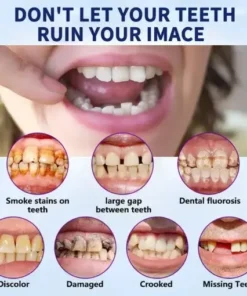 Advanced Full Denture Set