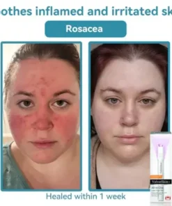 All-in-One CO₂ Laser Eraser Pen