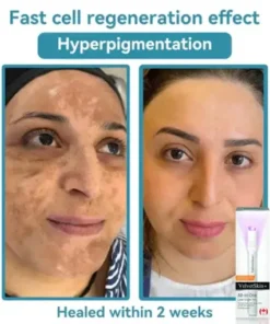 All-in-One CO₂ Laser Eraser Pen