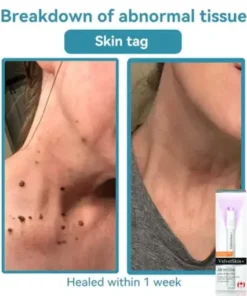 All-in-One CO₂ Laser Eraser Pen