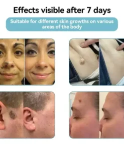 All-in-One Laser Eraser Pen