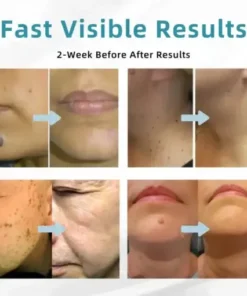 All-in-One Laser Eraser Pen