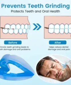 Anti-Snoring Guard