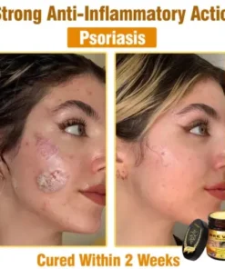 Bee Venom All-in-One Cream