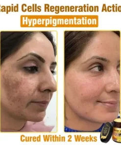 Bee Venom All-in-One Cream