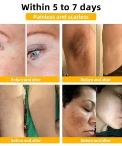 Bee Venom Skin Treatment Cream