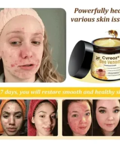 Bee Venom Skin Treatment Cream