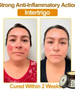 Botox Bee Venom Rapid Skin Repair Cream