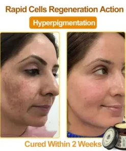 Botox Bee Venom Rapid Skin Repair Cream