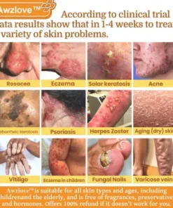 Botox Bee Venom Rapid Skin Repair Cream