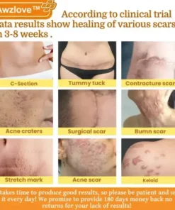 Botox Bee Venom Rapid Skin Repair Cream