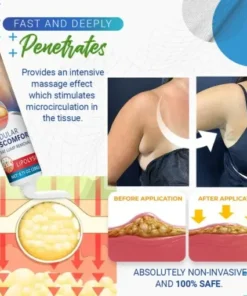 BumpClear Lipoma Removal Cream