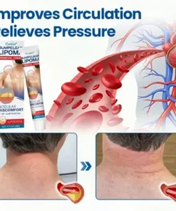 BumpClear Lipoma Removal Cream