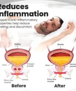 Copper Mag Prostate Therapy Ring