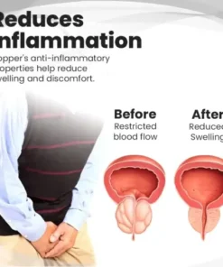 Copper Mag Prostate Therapy Ring