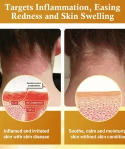 DermaFix Condense Mellifera Venom Skin Repairing Cream