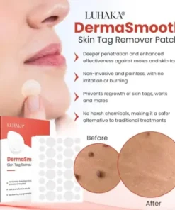 DermaSmooth Skin Tag Remover Patch