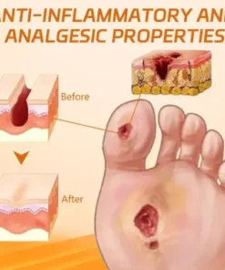 Diabetes Wound Strong Treatment Cream