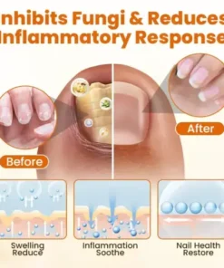 FungiBee Advanced Nail Repair Spray