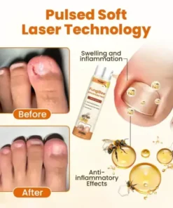 FungiBee Advanced Nail Repair Spray