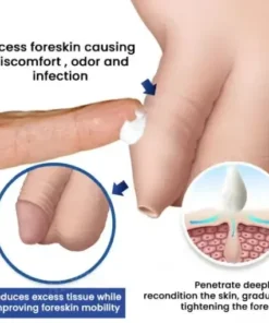 Glans Whitening & Foreskin Corrector Cream