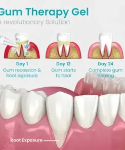 Gum Shield Therapy Gel