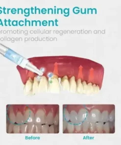 Gum Shield Therapy Gel