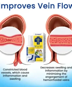 Herbal Hemorrhoids Fast-Acting Treatment Spray