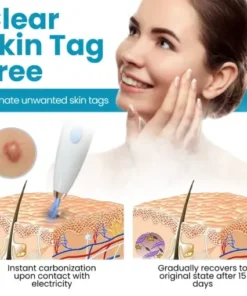 Home Use CO2 Laser Shot Erase Pro