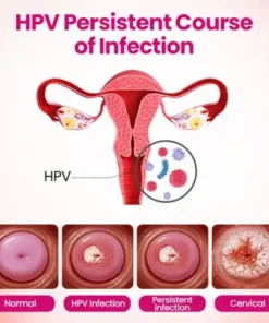 IntiDefend Anti-HPV Interferon Gel