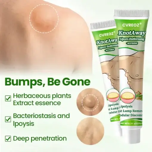 KnotAway Lipoma Removal Cream