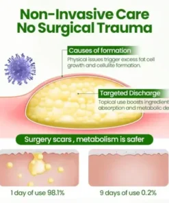 KnotAway Lipoma Removal Cream