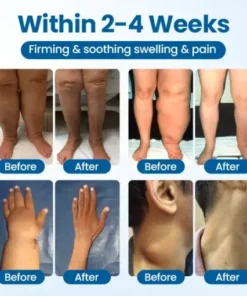 Lymphora Swelling Relief Roll-On