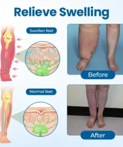 Lymphora Swelling Relief Roll-On