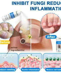 Magnesium Herbal Psoriasis Spray