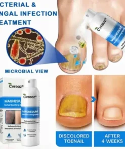 Magnesium Herbal Psoriasis Spray