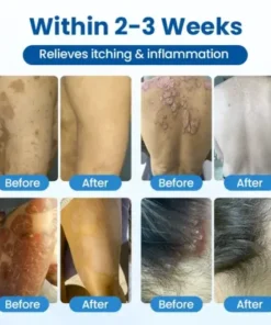 Magnesium Herbal Treatment Spray