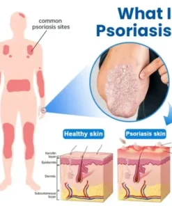 Magnesium Herbal Treatment Spray