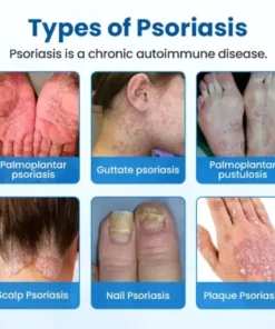 Magnesium Herbal Treatment Spray