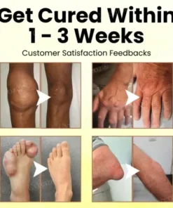 Magnesium Oil & Bee Venom Joint Healing Spray