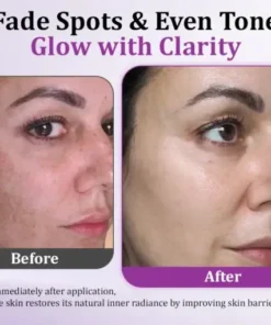 MelantraX Advanced Anti-Hyperpigmentation Essence