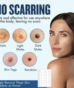 Moles & Warts Removing Skin Tag Patch