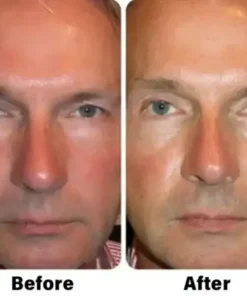 Nano Vision Repair Eye Serum