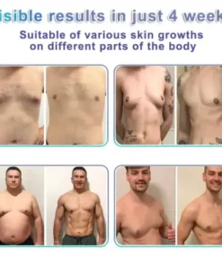 NanoMedix Gynecomastia Chest Fatburn & Firm Patch
