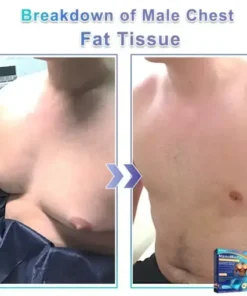 NanoMedix Gynecomastia Chest Fatburn & Firm Patch