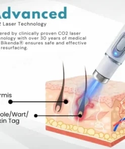 Non-Invasive Mole and Wart Removal Laser Pen