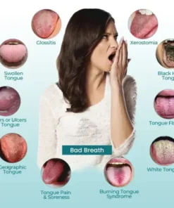 OralGuard Tongue Repair Spray