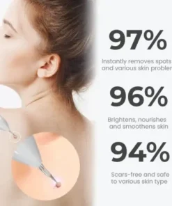 Portable Laser Spot Cleaning Pen