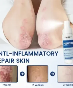 PsoriCure Magnesium Herbal Spray